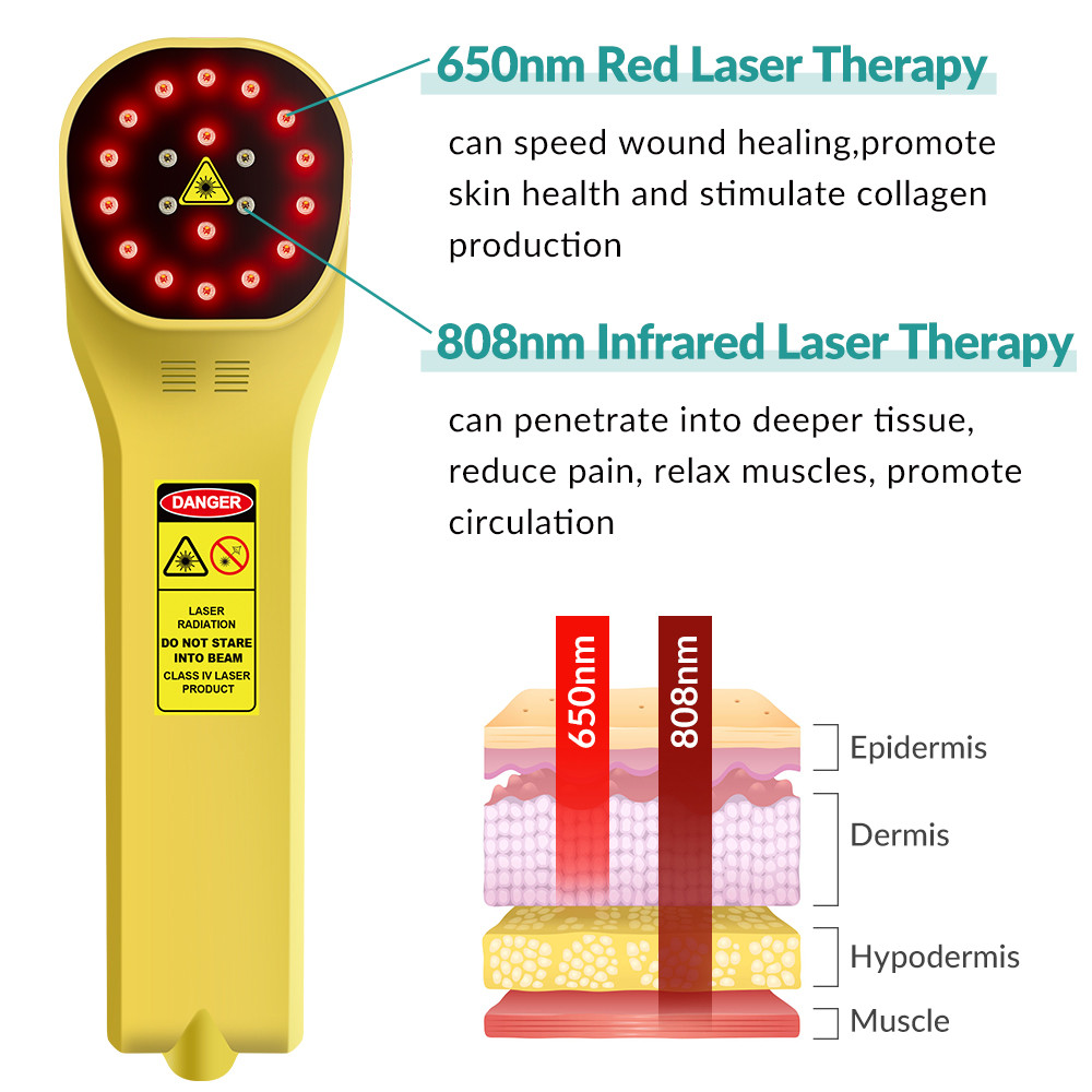 808nm Deep Tissue Laser Therapy Cold Laser Treatment Physiotherapy Laser Therapy Device Pain Human a