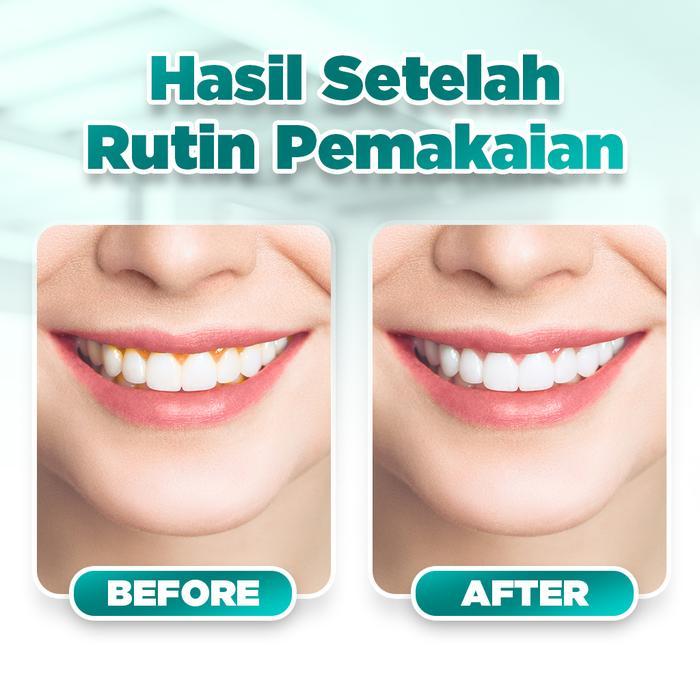 58x7- Pieras Propolinse Sikat Gigi Elektrik Dan 5 Botol Propolinse