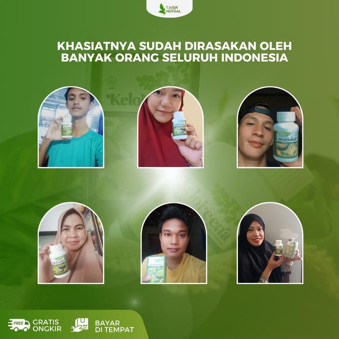 qgk4- Keloreena Atasi Mata Juling Pada Anak Dan Dewasa, Mata Miring, Mata Juling Sebelah,