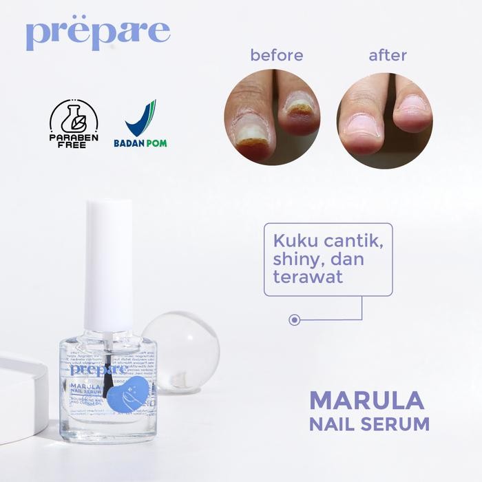 Sale Jamur Kuku Rusak Nail Serum Kuku Cantengan Perawatan Kuku Kaki dan Tangan Obat Jamur Kuku Kaki