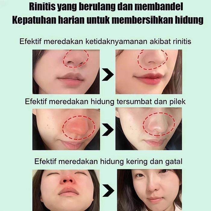 Promo 30Ml Nasal Spray Sinusitis Pembersih Hidung Sinusitis Onat Polip Hidung Semprotan Hidung Anak