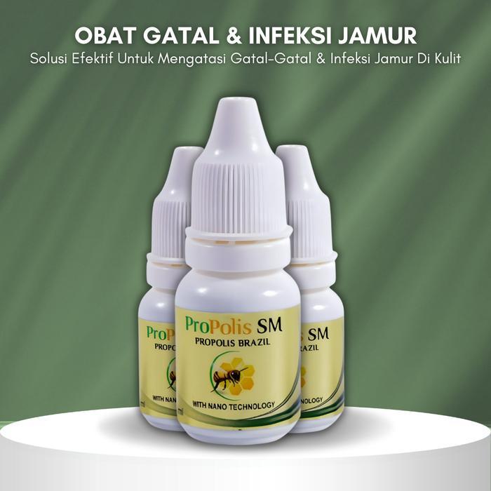 Propolis SM Solusi Untuk Mengatasi Alergi Semen, Dermatitis Kontak, Salep Tangan Alergi Semen