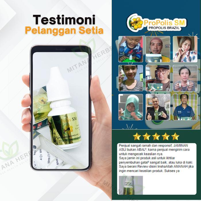 vfvv- Propolis Sm Mata Kaki Hitam, Kaki Kapalan, Mata Kaki Hitam Dan Kering, Kaki Pecah