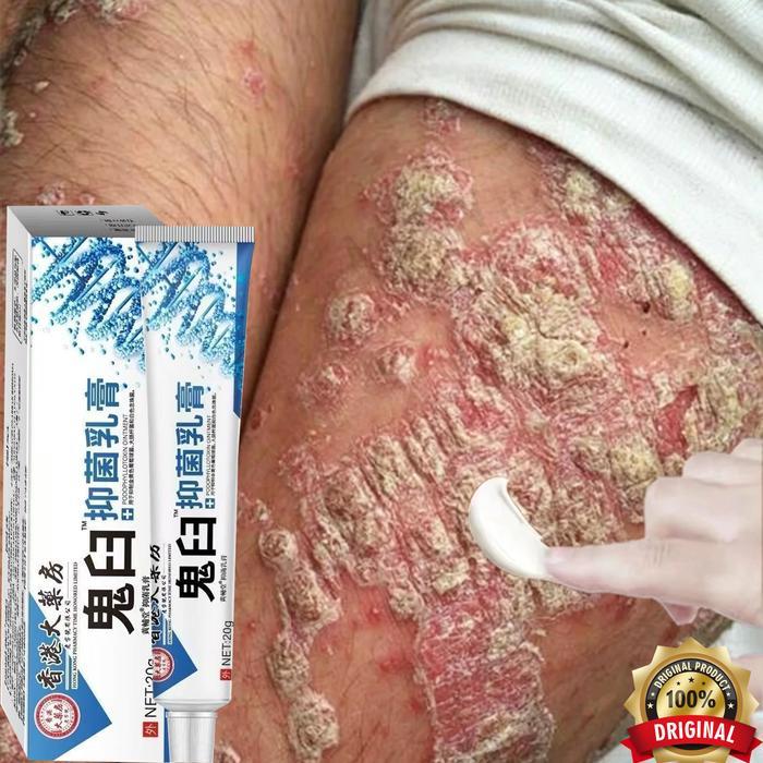 Krim Anti Gatal Krim Anti Gatal Paling Efektif Krim Anti Gatal Selangkangan 20G Cream Gatal Kulit