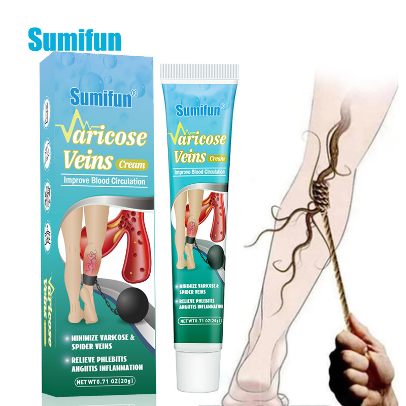 20g/pc Feet Varicose Veins Cream Treatment Dilated Capillaries Removal Phlebitis Spider Leg Veins
