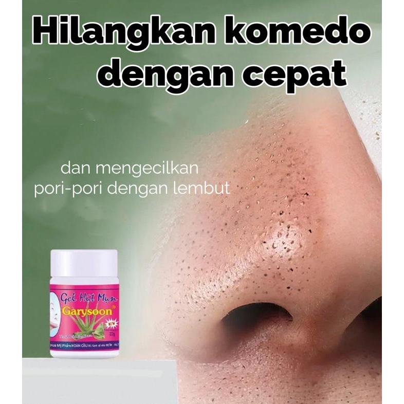 Menghilangkan komedo dan jerawat di hidung dengan cepat Masker dan gel penghilang komedo di hidung