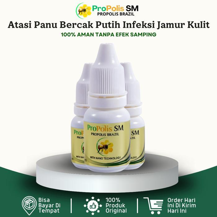 i0cc- Salep Panu Di Wajah Bercak Putih Infeksi Jamur Kurap Kudis Eksim Propolis Sm 6Ml