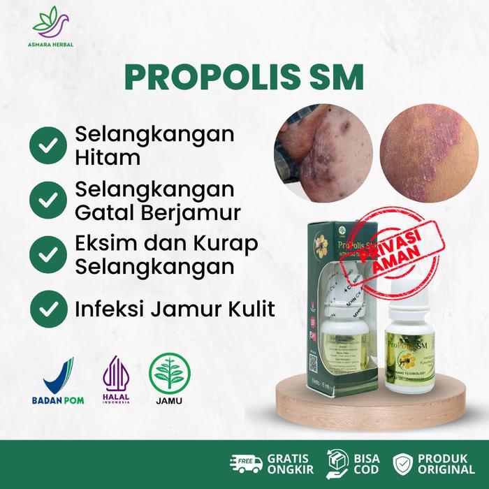 Propolis SM – Oles Untuk Selangkangan Hitam, Gatal & Berjamur untuk Pria & Wanita