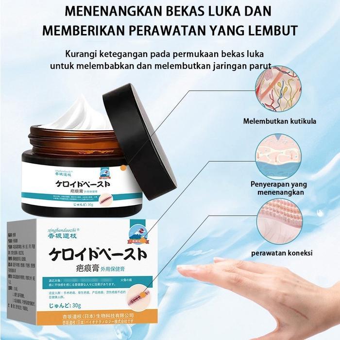 Penghilang Bekas Luka Bekas Gigitan Nyamuk Bekas Luka Tua Penghapu Ampuh Menghilangkan Bekas Luka