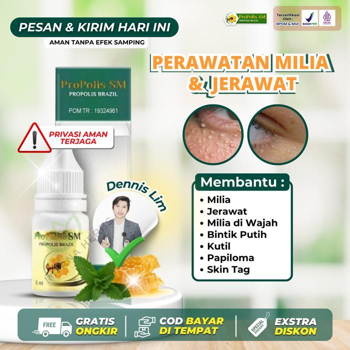 9f2q- Propolis Sm Penghilang Milia, Jerawat Milia, Milia Di Wajah, Milia Di Sekitar Mata,