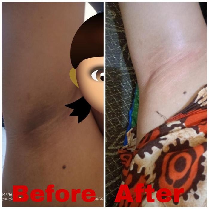 CREAM LIPATAN BIERLIAN