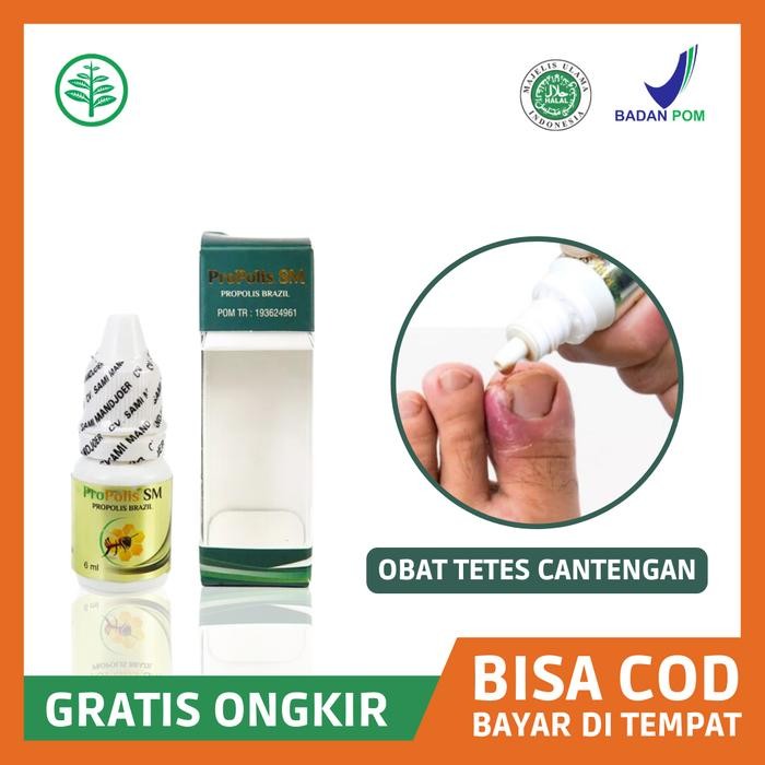 Sale Obat Jempol Kaki Bengkak Bernanah, Obat Cantengan Propolis SM Ori BPOM Terlaris