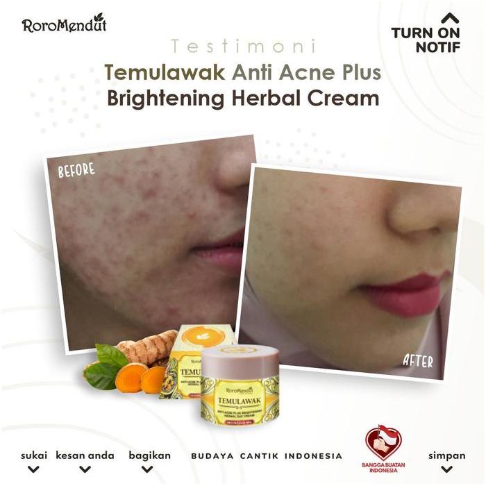 Roro Mendut Starter Temulawak Anti Acne Brightening Paket Skincare