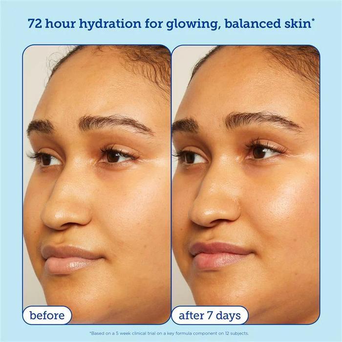Skinfix Acne+ Triple Threat Set kit
