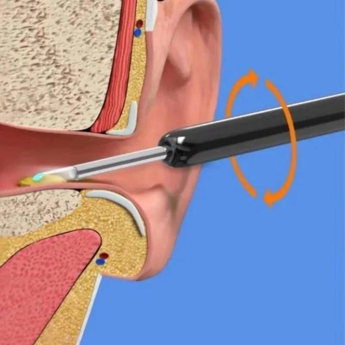 Kamera Telinga Alat Pembersih Telinga Endoskopi Visual Hd Earwax Clean