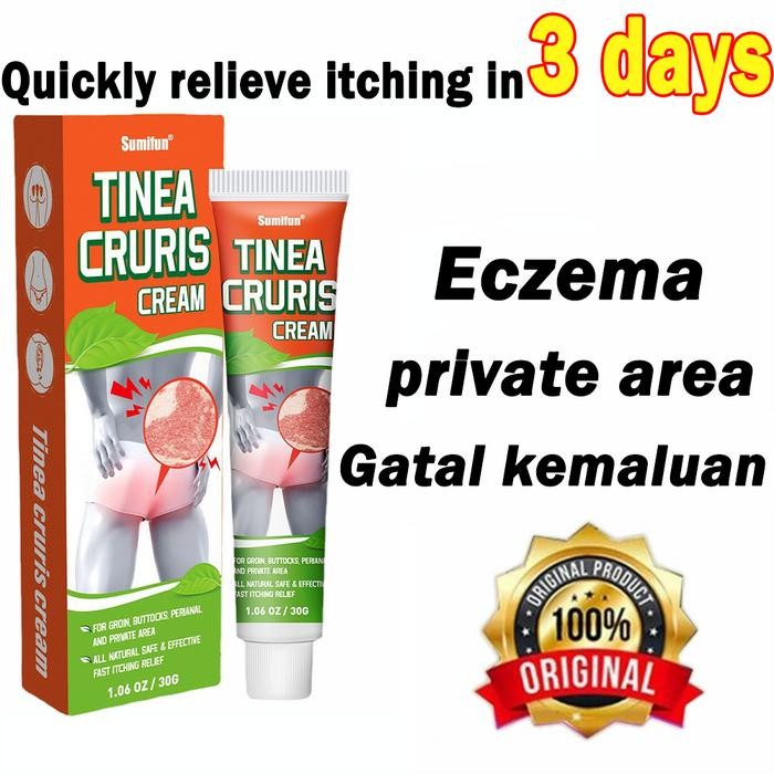 KRIM GATAL GATAL KULIT SALEP GATAL SELANGKANGAN 30G