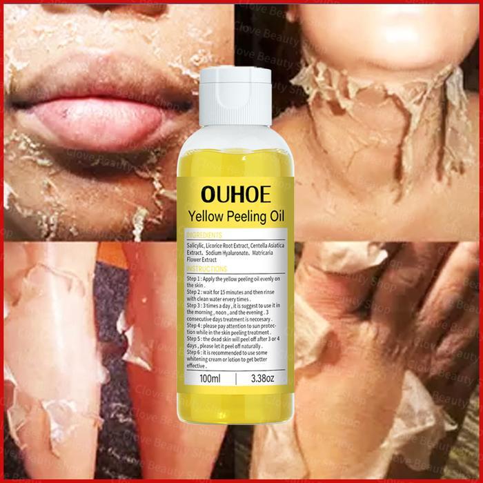 Yellow Peeling Oil 100ml Skin Peeling Body Peeling For Whitening Body Clarity Essentials Minyak