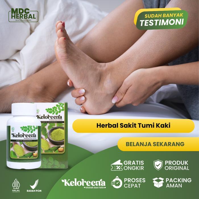 Herbal Sakit Tumit Kaki, Sakit Telapak Kaki, Nyeri Tumit, Nyeri Kaki, Plantar Fasciitis, Radang