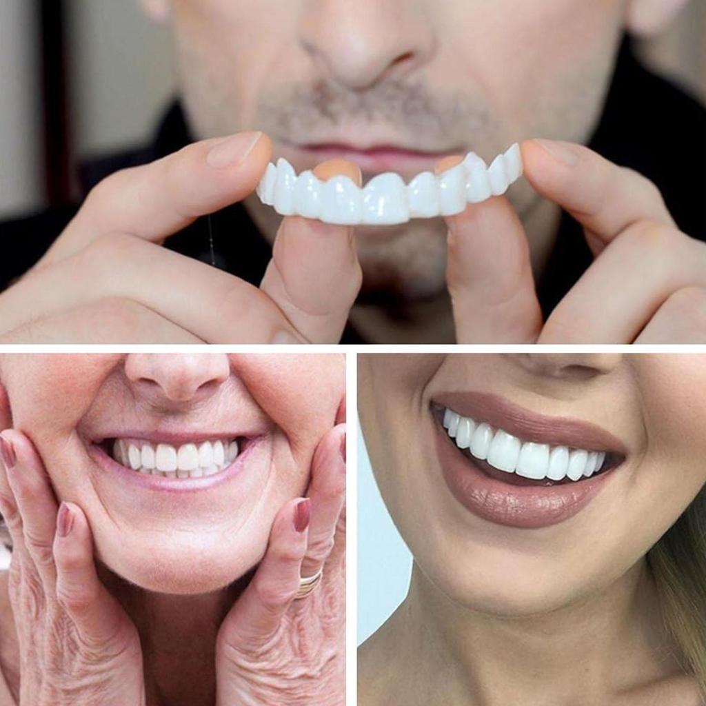Veneers Teeth for Women Instant Veneers Upper and Lower Set Smile Improver Comfortable Tooth