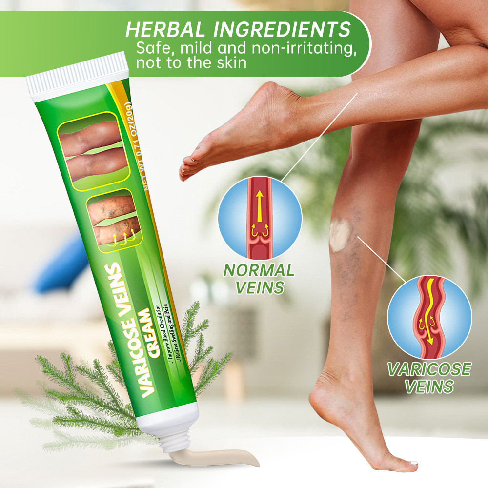 Ointment for Varicose Veins Eliminate Spider Legs Spider Vein to