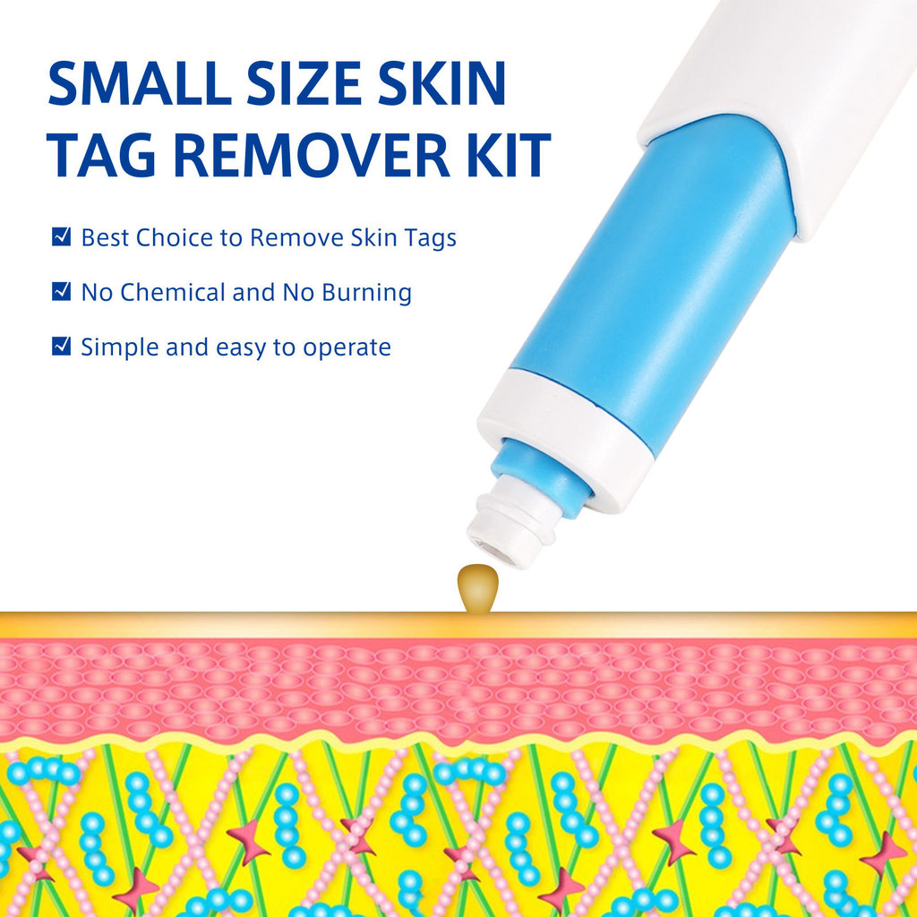 Skin Tag Removal Mole Small rt Removal Faial Mole rt Mirostrip Tag Removal Kit Automati Mole Remover