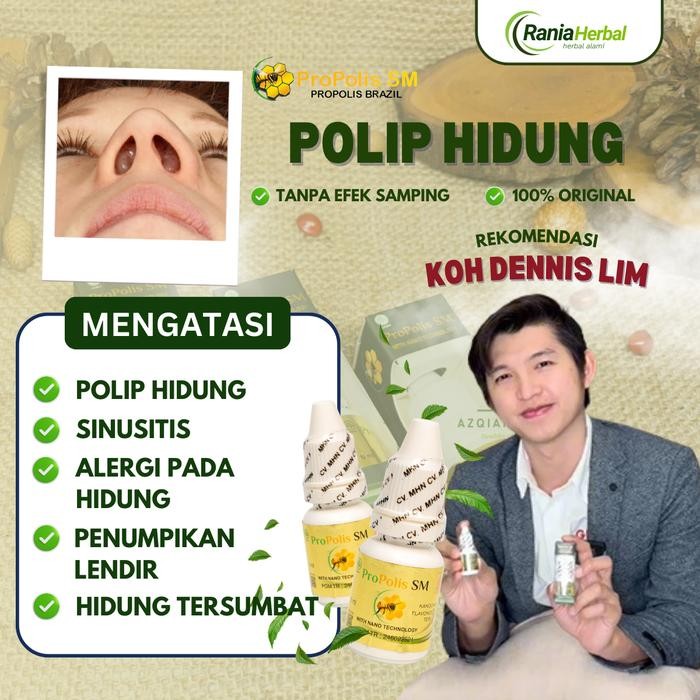 Sale Tetes Polip Hidung, Sinusitis, Rhinitis, Hidung Bau Busuk, Benjolan Salam Hidung, Hidung