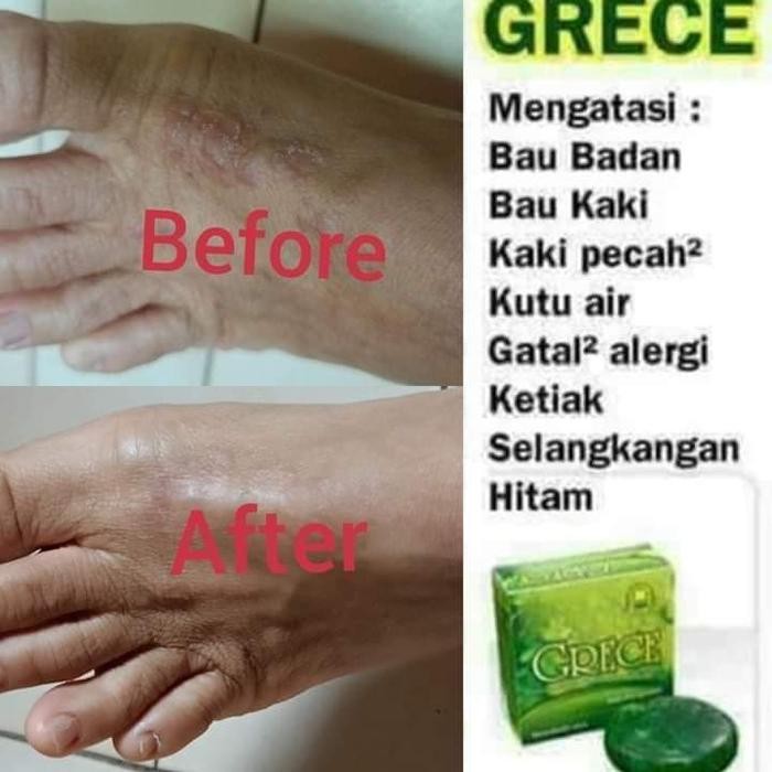 GRECE BODY CRYSTAL NASA PENGHILANG PANU BIANG KERINGAT & KETIAK HITAM