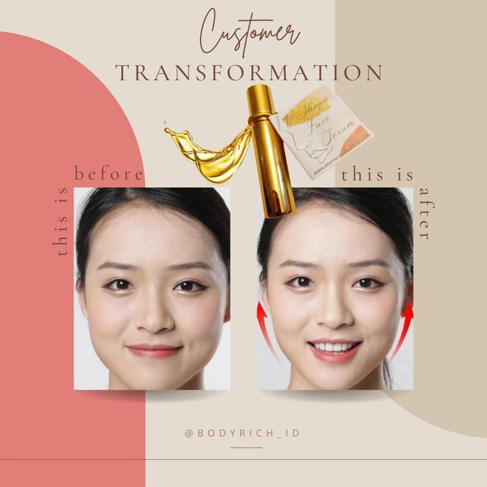 Ready Serum Penirus Wajah Pipi Dagu V Shape Face Serum Pelangsing Wajah Dagu Premium