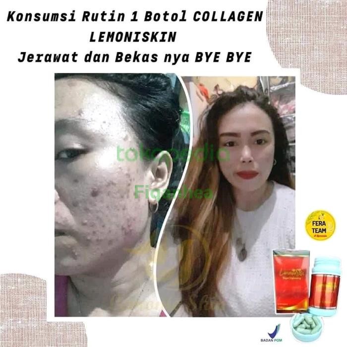 COLLAGEN DLEMONIE PEMUTIH BADAN