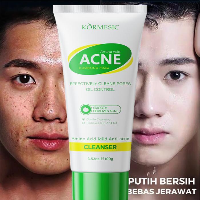 Pembersih Wajah Pria Pembersih Wajah Jerawat 100g Pembersih Wajah Pria Pemutih Wajah Pria Face Wash