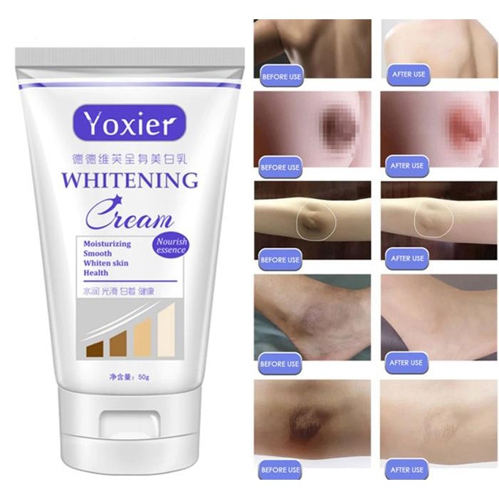 ASLI YOXIER 50GR CREAM PEMUTIH KETIAK LUTUT SIKU HITAM DAN JAMURAN