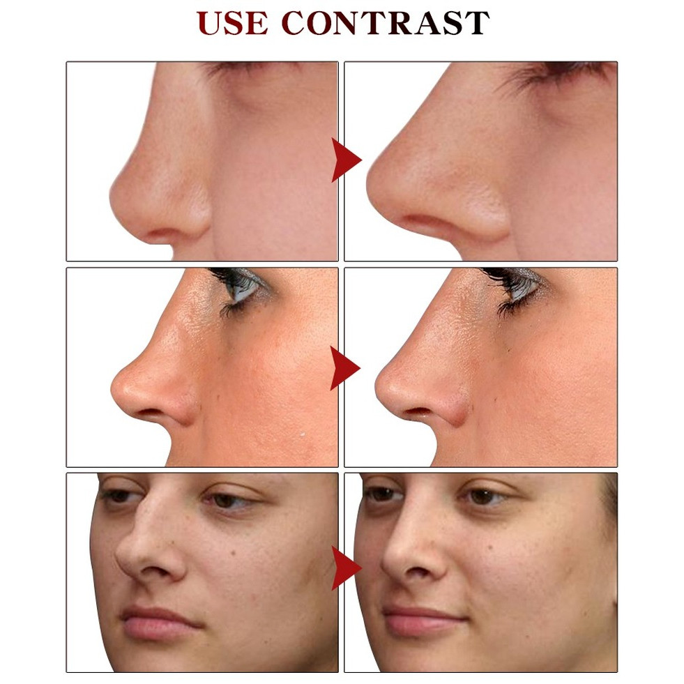 Nose Up Heighten Rhinoplasty oil Nose Up Heighten Rhinoplasty Firming Nasal Bone Remodeling Pure Nat