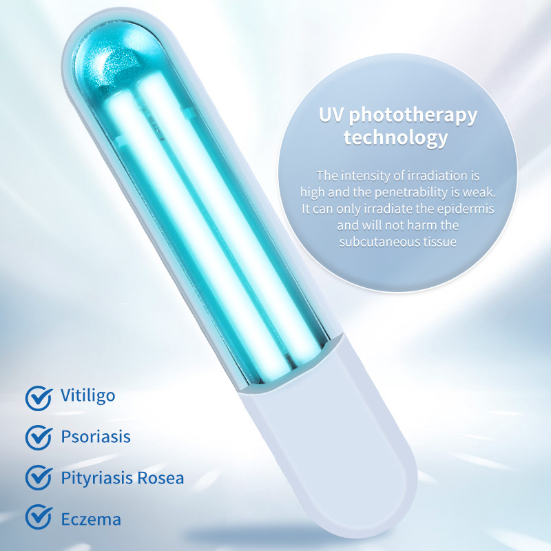 311nm Portable Eximer UVB Phototherapy Mahine Devie UV Light Therapy Devie for Vitiligo Psoriasis