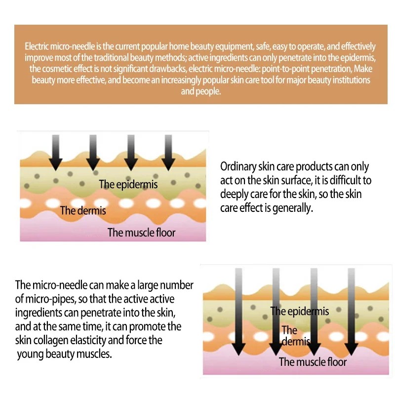 10/20/50/100Pcs Bayonet Dermapen Micro Needles for UltimaA6 Dr.imp Pen Microneedling