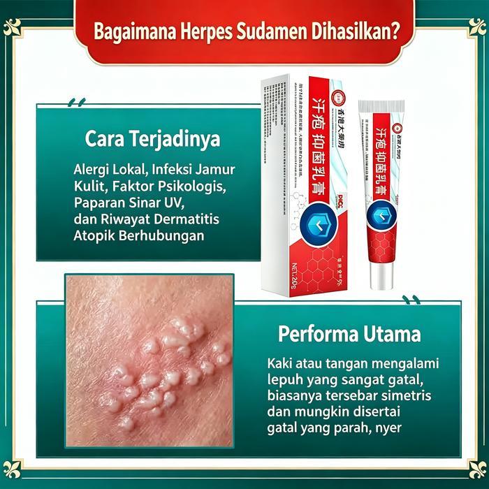 Salep Gatal China Paling Ampuh Salep Gatal Jamur Selangkanga Krim Eksim Bayi Dan Anak Obat Gatal