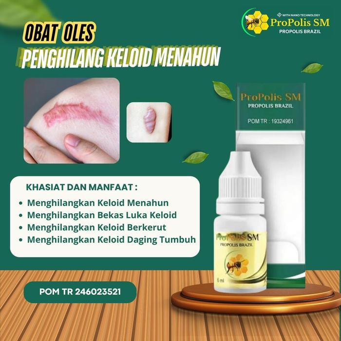 Salep Oles Keloid Menahun, Bekas Luka Menonjol, Pengilang Keloid Berkerut , Keloid Di Wajah, Keloid