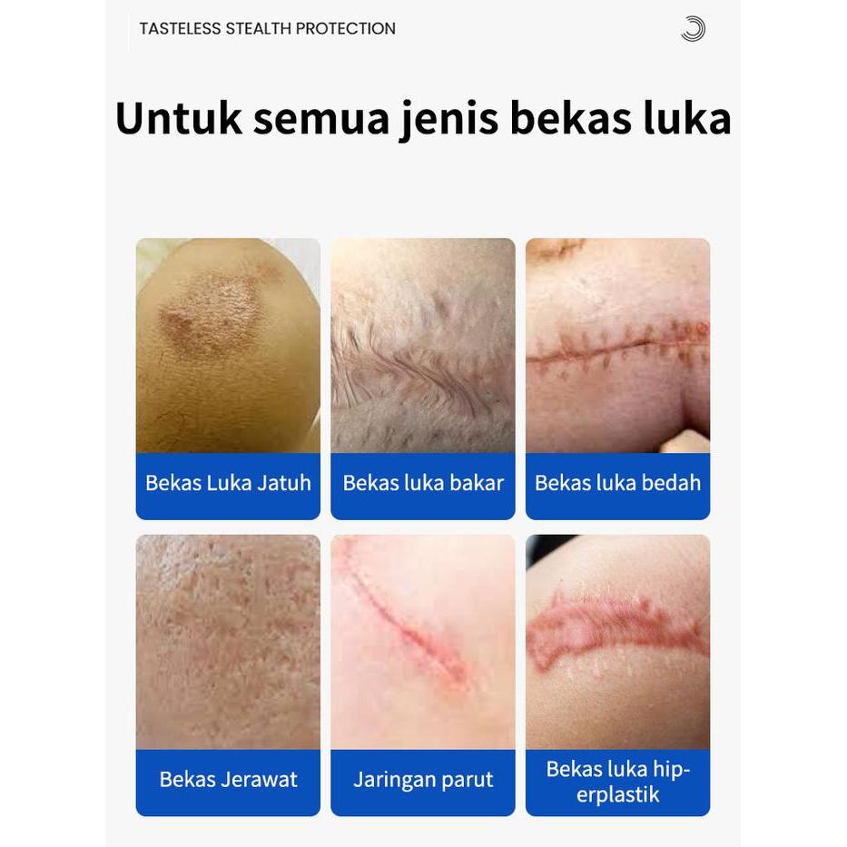 penghilang bekas luka ampuh Penghilang bekas luka Acne Cream Scar Removal Penghilang Noda Bekas
