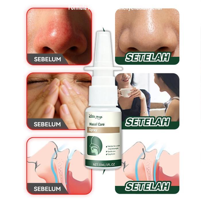 Ready 30Ml Nasal Spray Sinusitis Pembersih Hidung Sinusitis Onat Polip Hidung Semprotan Hidung Anak