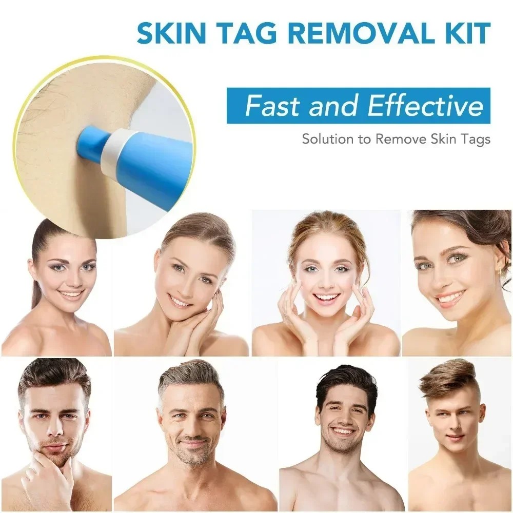 2IN1 Auto Skin Tag Removal Tool Kit Painless Skin Label Mole Ae rt Removal Pen with leansing Sbs