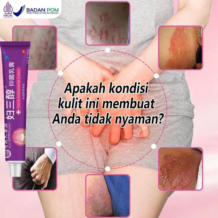 Cream Gatal Selangkangan Cream Tinea Krim Antipruritik Paling Efektif Cream Gatal Selangkangan 20G
