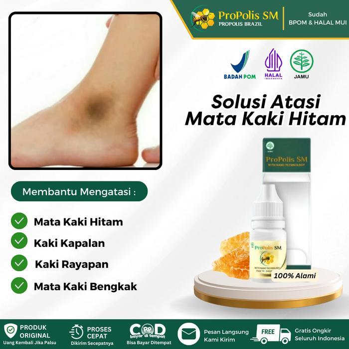 Propolis Sm Salep Oles Untuk Mata Kaki Hitam, Pemutih Mata Kaki Hitam, Mata Kaki Hitam Dan Kasar