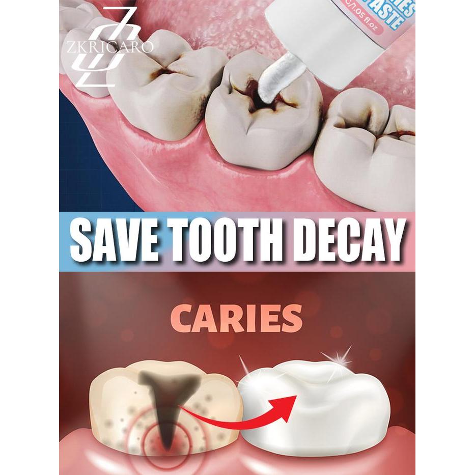 ANTI-CAVITY TOOTHPASTE TOOTH REMINERALIZATION RECOVERY ENAMEL REPAIR STRENGTHENING RESTORATION DECAY