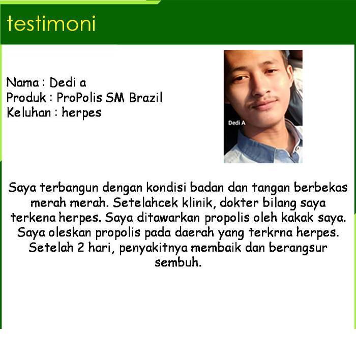 Propolis Sm Untuk Herpes Di Bibir Bibir Bengkak Bintik Bintik Di Mulut Luka Lepuh Di Bibir Bintik
