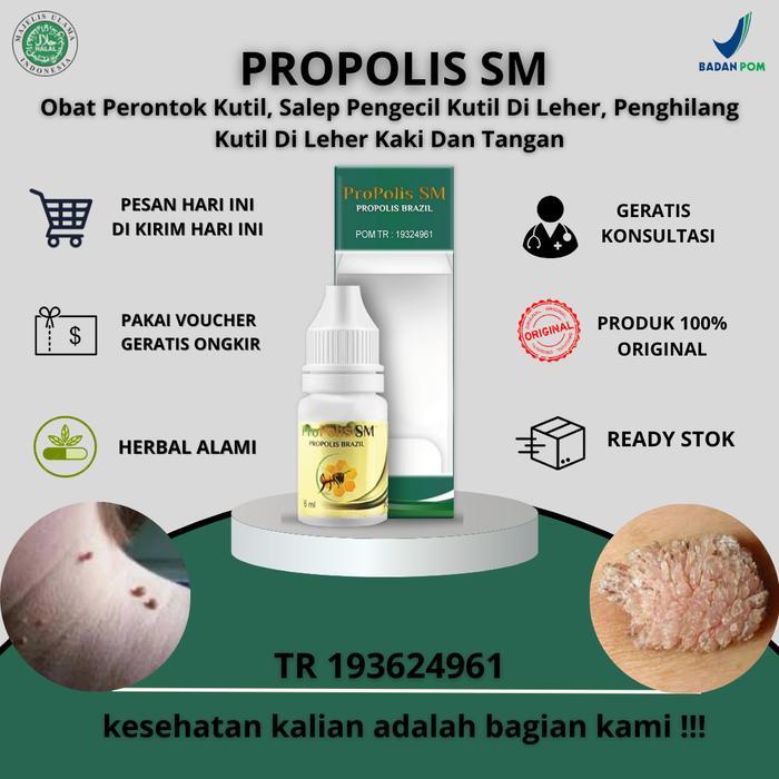Terpercaya. Suplemen Perontok Kutil, Salep Pengecil Kutil Di Leher, Penghilang Kutil Di Leher Kaki