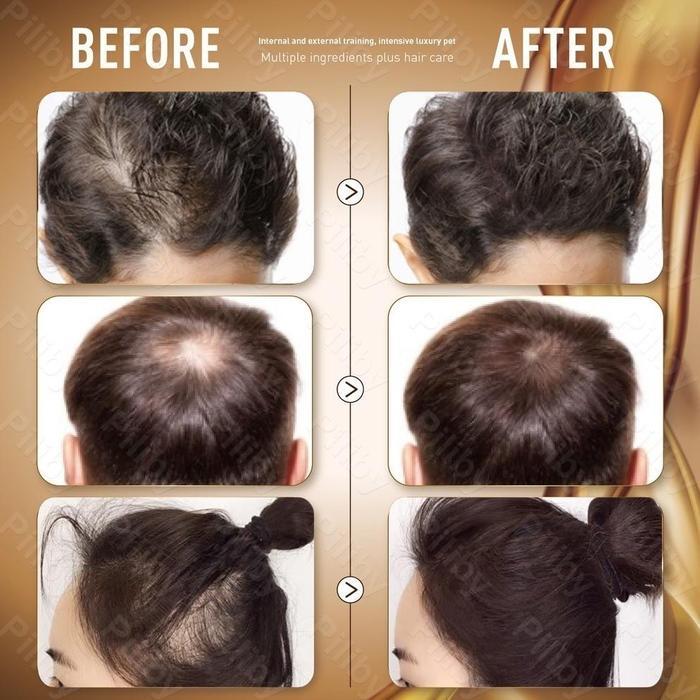 Shampoo Penumbuh Rambut Cepat Ginger Shampoo Shampoo Penumbuh Rambut Shampoo Anti Rontok Shampoo