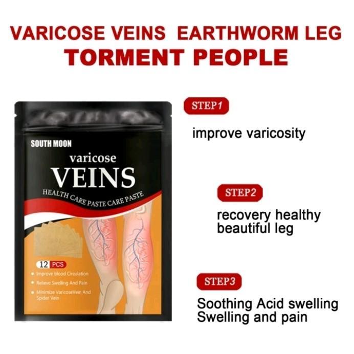 Terlaris South Moon Koyo Varicose Selatan Bulan Koyo Koyo Kaki Membantu Mengatasi Masalah Varises