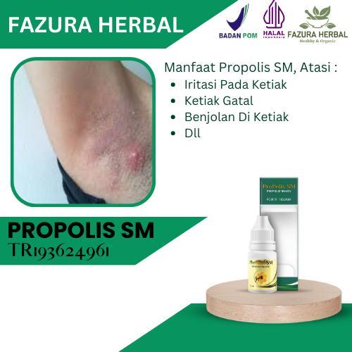 Flash Sale Propolis Sm - Iritasi Pada Ketiak, Ketiak Gatal