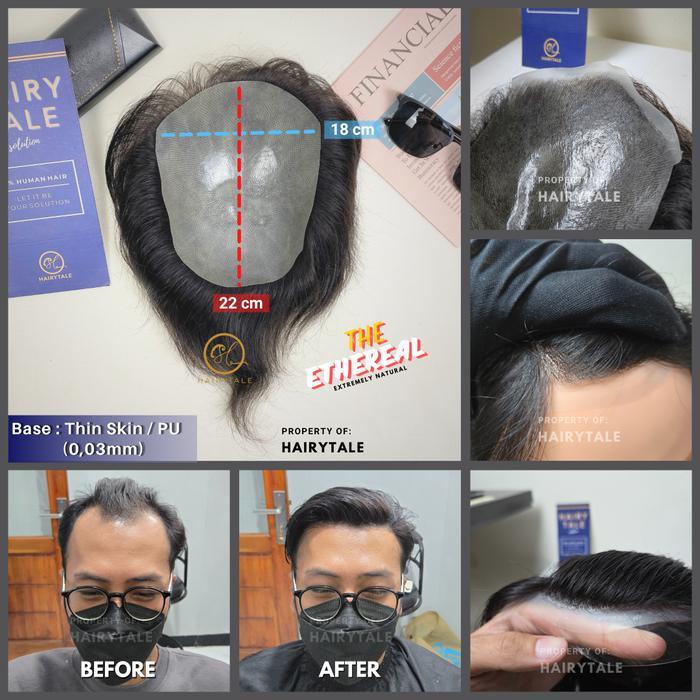 Toupee Hair System Pria, Thin Skin 0,03mm, Ukuran 18x15cm - 25x20cm, Ready Stock, Hairytale