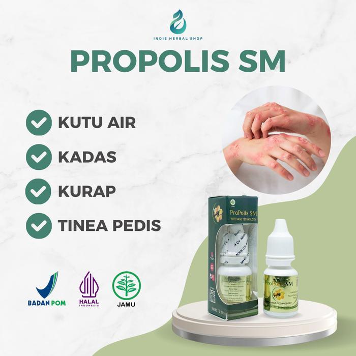 Obat Oles Kutu Air, Kadas, Kurap, Tinea Pedis - Propolis SM - BPOM dan Halal MUI