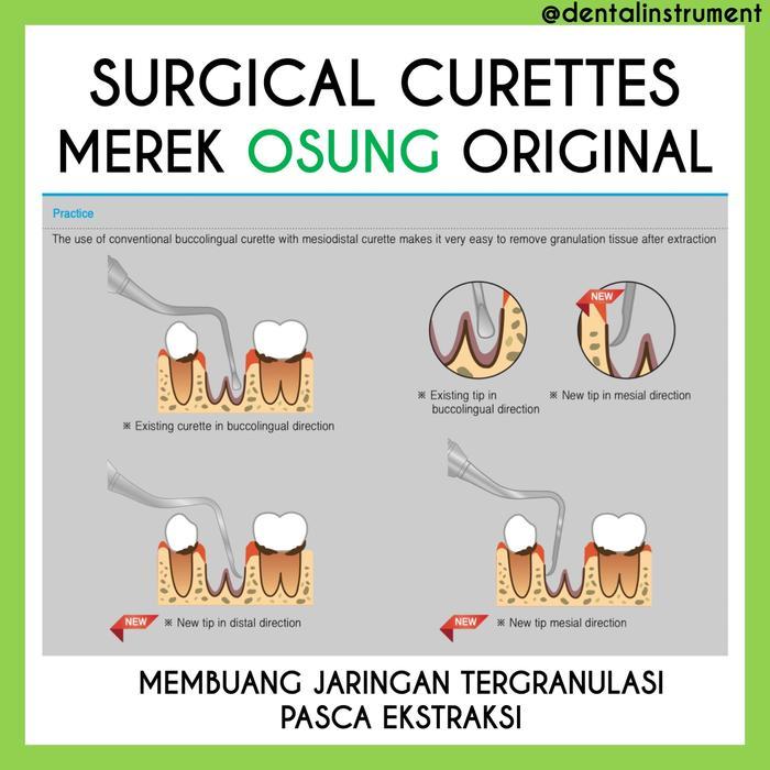 SURGICAL CURETTES / KURET BEDAH MULUT GIGI MEREK OSUNG ORIGINAL